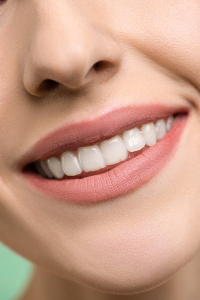 A close-up image focusing on a woman's smiling mouth, showing white teeth and pink lips.